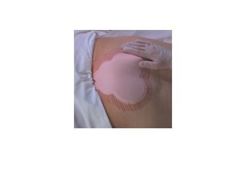 Allevyn sacrum medicazione speciale 225 x 221cm 10 pezzi