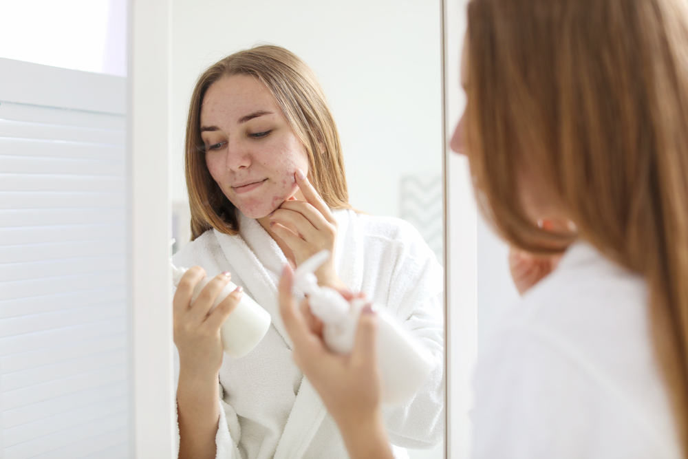 Acne in età adulta: cause e soluzioni dermatologiche